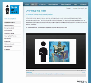 afbeelding 2 project Heupopmaat.nl