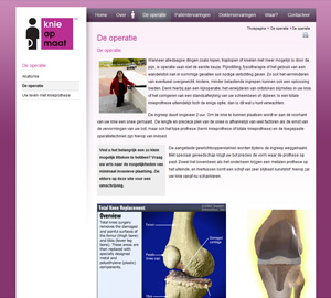 afbeelding 3 project Knieopmaat.nl